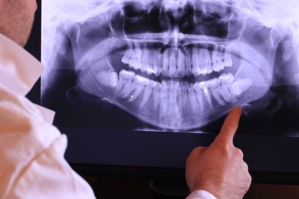 Best Emergency Dentist for Lost Fillings or Crowns in Lorenz Park, NY
