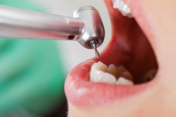 Best Broken or Cracked Tooth Emergency Dentist in Lorenz Park, NY